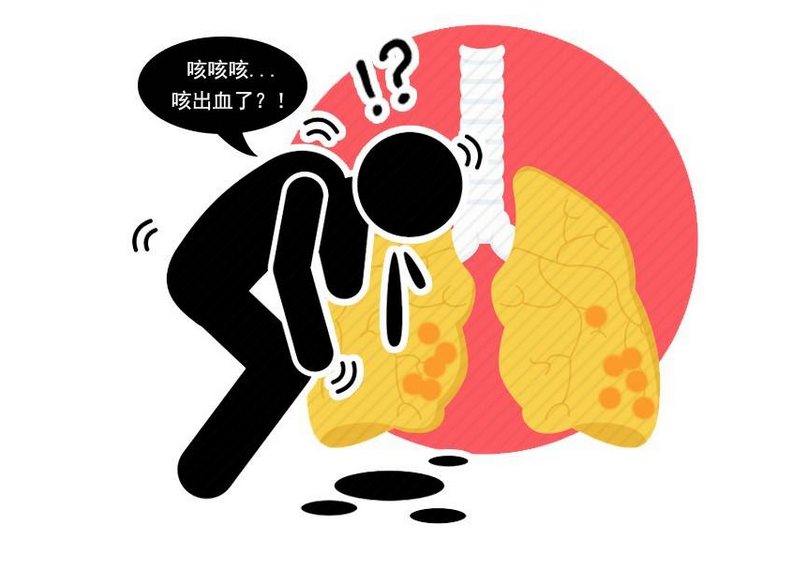 肺病结核严重是肺癌吗_肺病结核严重是肺结核吗_肺结核是严重的病吗