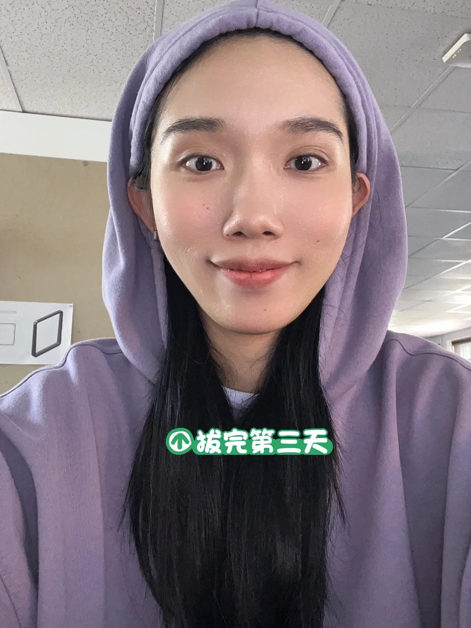 诊断冠心病的金标准是_冠心病诊断_诊断冠心病的三个指标
