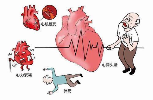 冠心病的病历护理计划怎么写_护理冠心病病历写计划书怎么写_冠心病护理病历书写范文模板