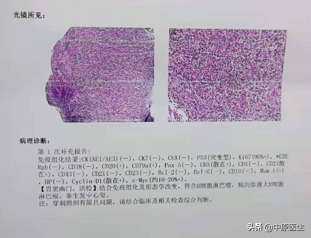 洛阳胃病中医_洛阳中医治疗胃溃疡医院_洛阳看胃病有名的中医医生