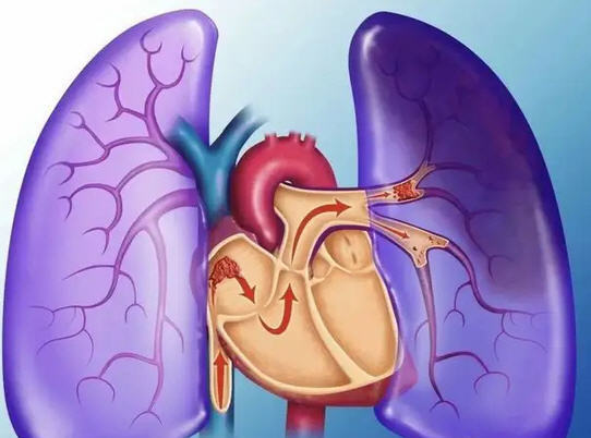 后背痛然后到前胸痛_后背疼痛引起前胸痛_前胸后背疼痛八种病因